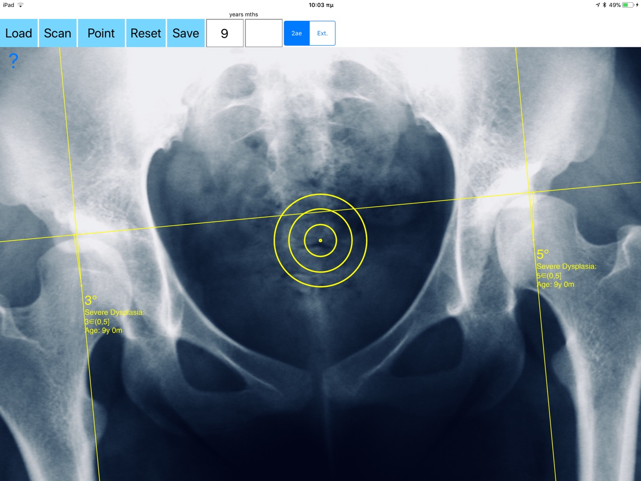 Screenshot 8 of CenterEdgeAngleApp