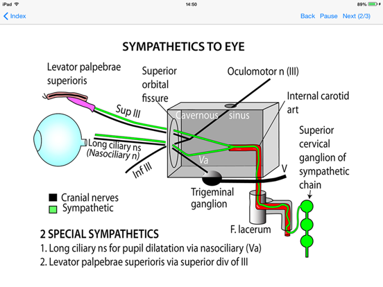 Tricky Areas of Anatomy iPad screenshot 4 - Medical app
