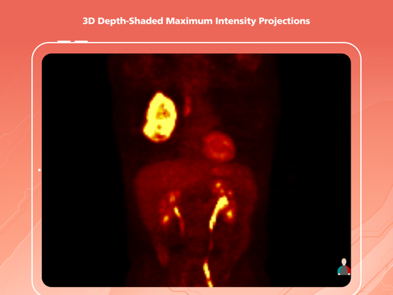 VueMe iPad screenshot 6 - Medical app