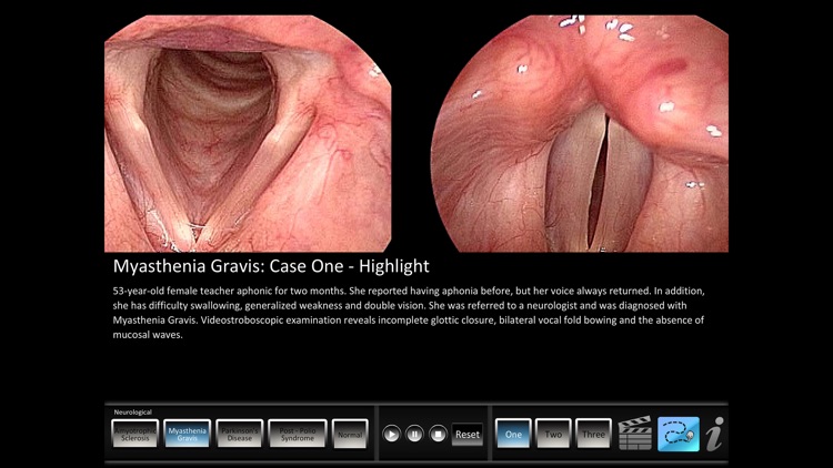 Vocal Pathology: Neurological screenshot-0