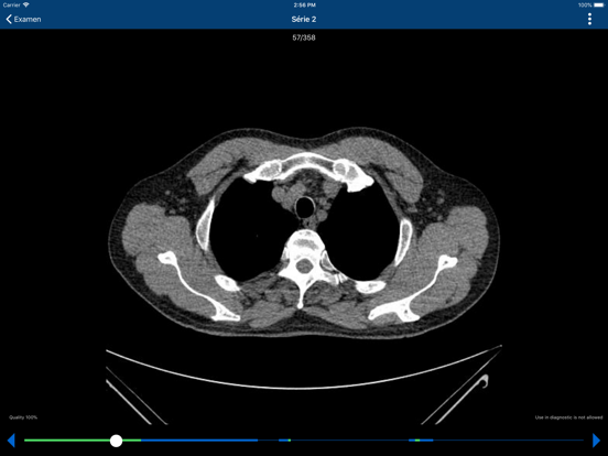 Screenshot #6 pour Toutoui
