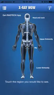 x-ray wow problems & solutions and troubleshooting guide - 3