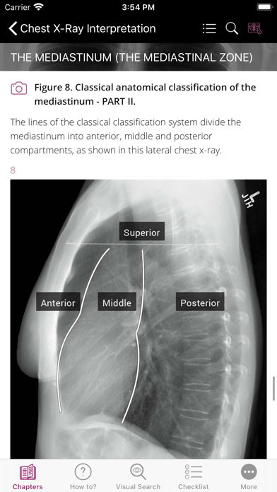 Chest X-ray Interpretation screenshot 3