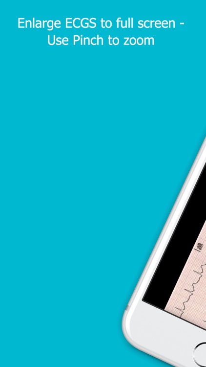 12 Lead ECG Challenge screenshot-5