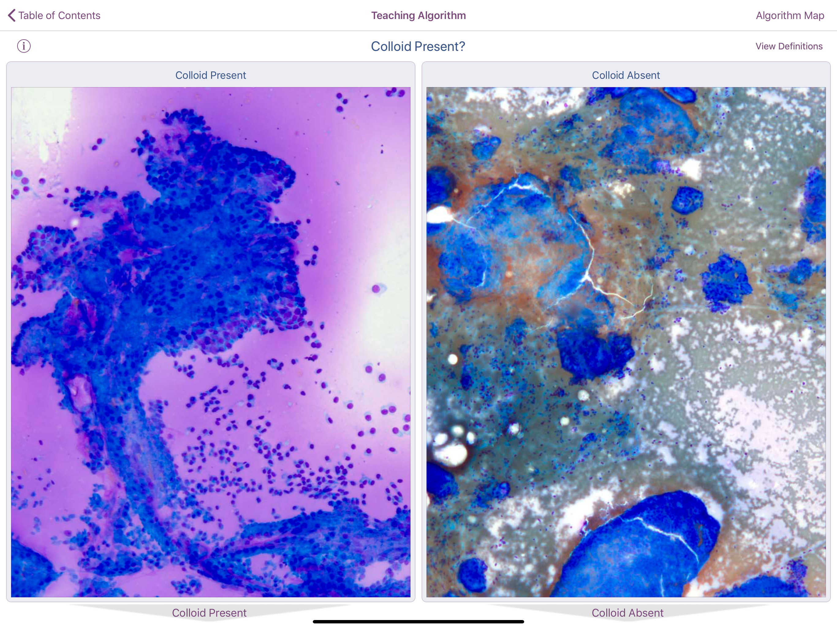 Thyroid Pathology screenshot 3