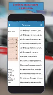 ЭКГ: Расшифровка и тесты. lite айфон картинки 2