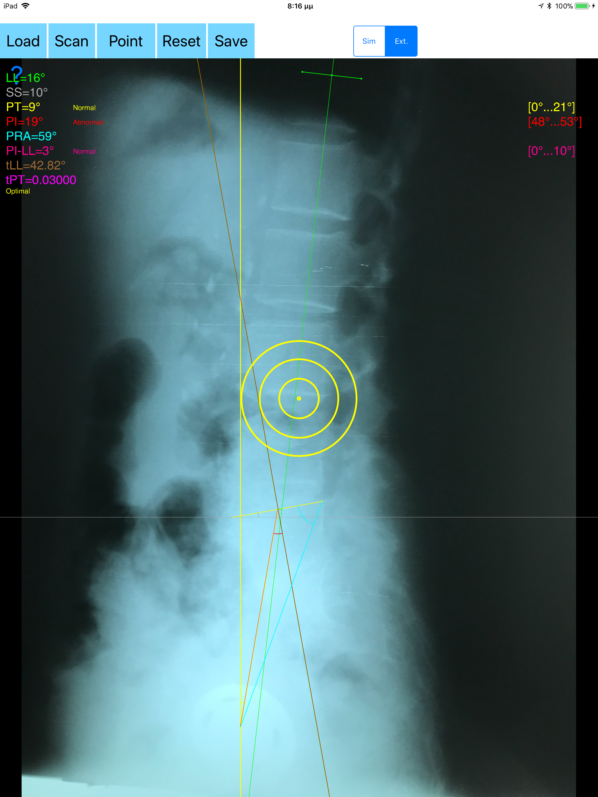 SpinopelvicBalanceApp