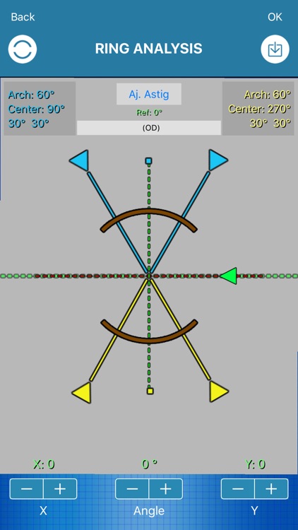 Eye Axis Check