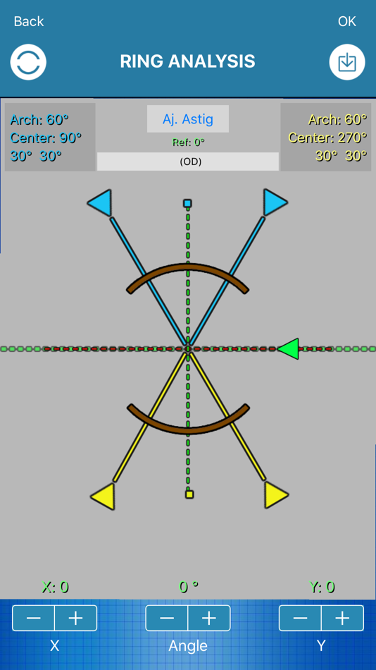 #3. Eye Axis Check (iOS) 由: Francisco Aecio Fernandes Dias