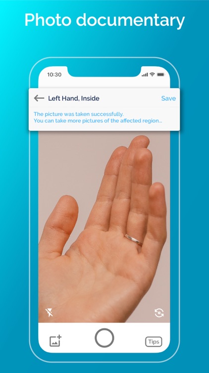 Eczema App | Nia
