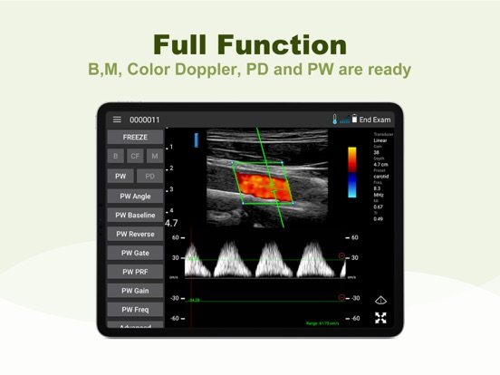 Screenshot #5 pour LELTEK Ultrasound - LeSono