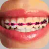 Braces Photo Editor - Stickers contact information