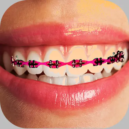 Braces Photo Editor - Stickers Cheats