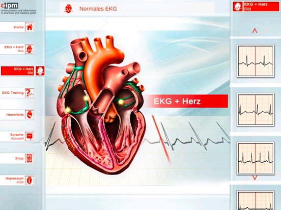 Screenshot #6 pour ECGinMotion Abo