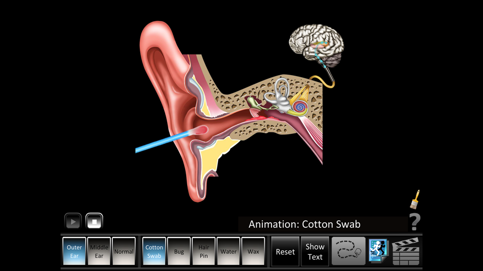 #1. Ear Disorders: Outer Middle (iOS) 由: Blue Tree Publishing, Inc.