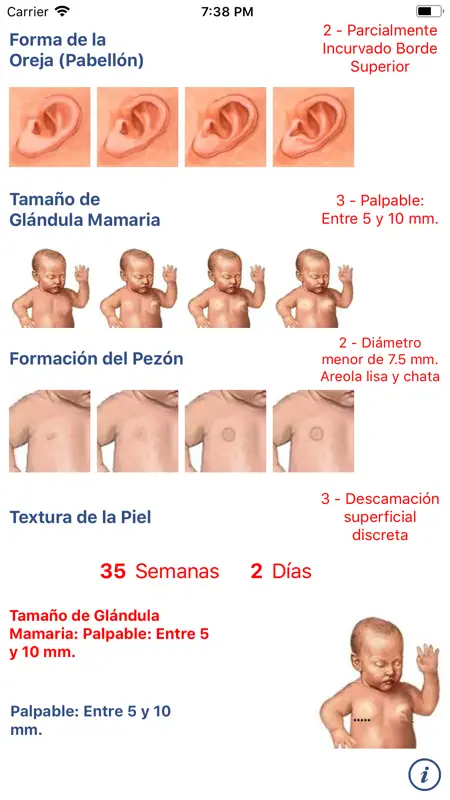 Neonatología: Método Capurro screenshot 1 of 4