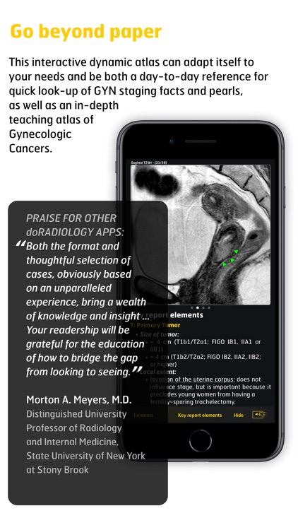 Gyn Cancer Staging Atlas