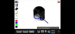 Game screenshot Oral Disorders hack