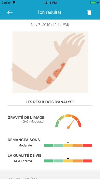 Screenshot #2 pour EczemaLess Assistante d'eczéma