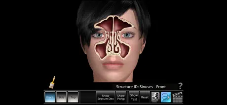 Sinus ID