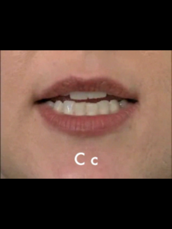 SmallTalk Letters,Number,Color iPad screenshot 4 - Medical app