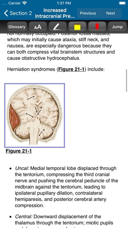 Harrison’s Manual of Med. 20/E screenshot-5