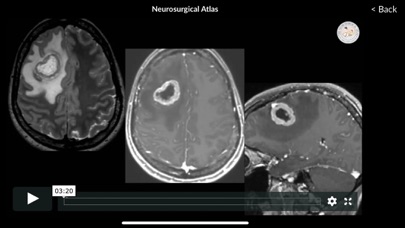 Neurosurgical Atlas Screenshot