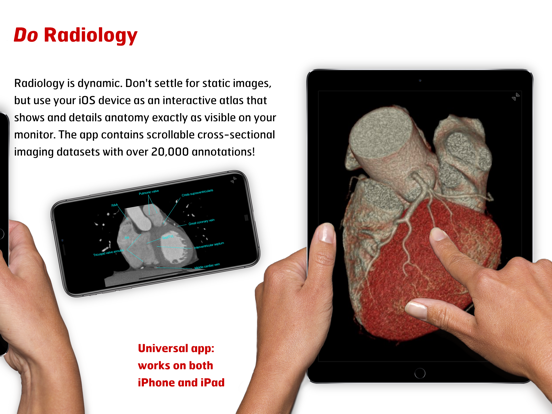 Screenshot #6 pour Radiology - Clinical Anatomy