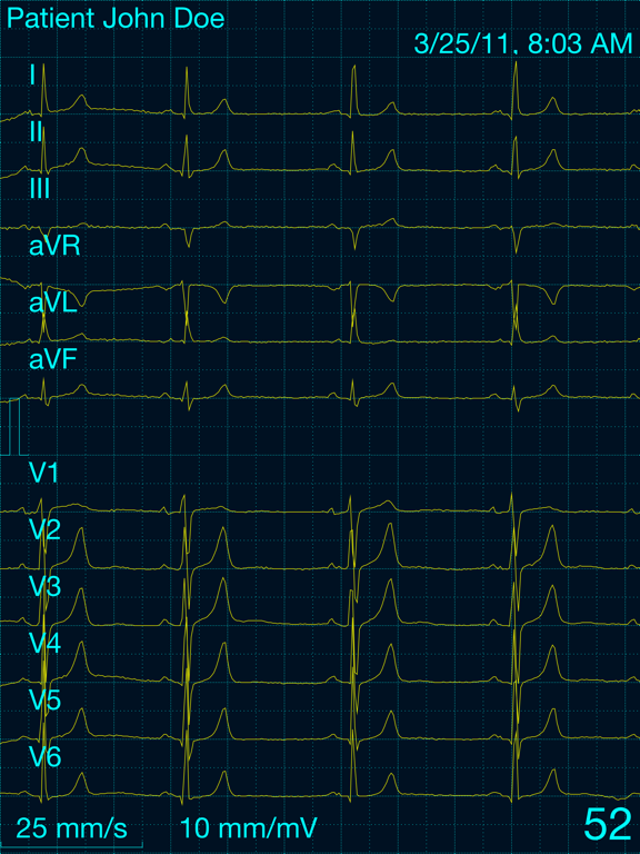 Screenshot #5 pour Cardiax
