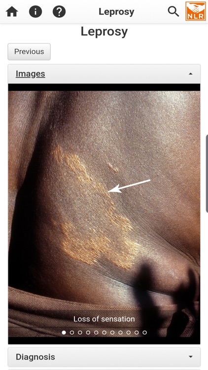 SkinApp NLR screenshot-4