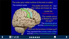 Neuroanatomy - SecondLook iPhone image 2