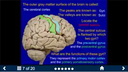 Game screenshot Neuroanatomy - SecondLook apk