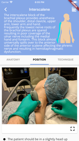Regional Anesthesia Reference screenshot