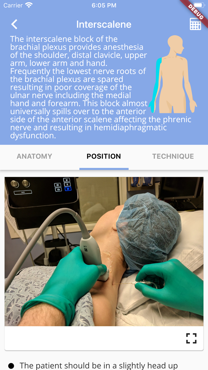 Regional Anesthesia Reference