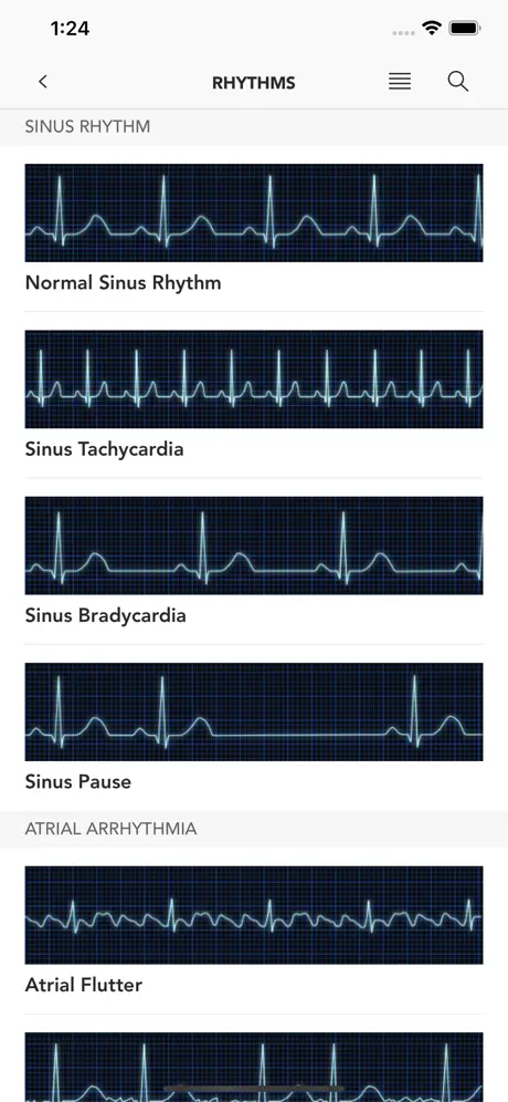 Instant ECG - Mastery of EKG