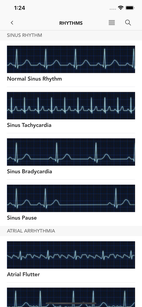 Instant ECG - Mastery of EKG - Medical App | MWM