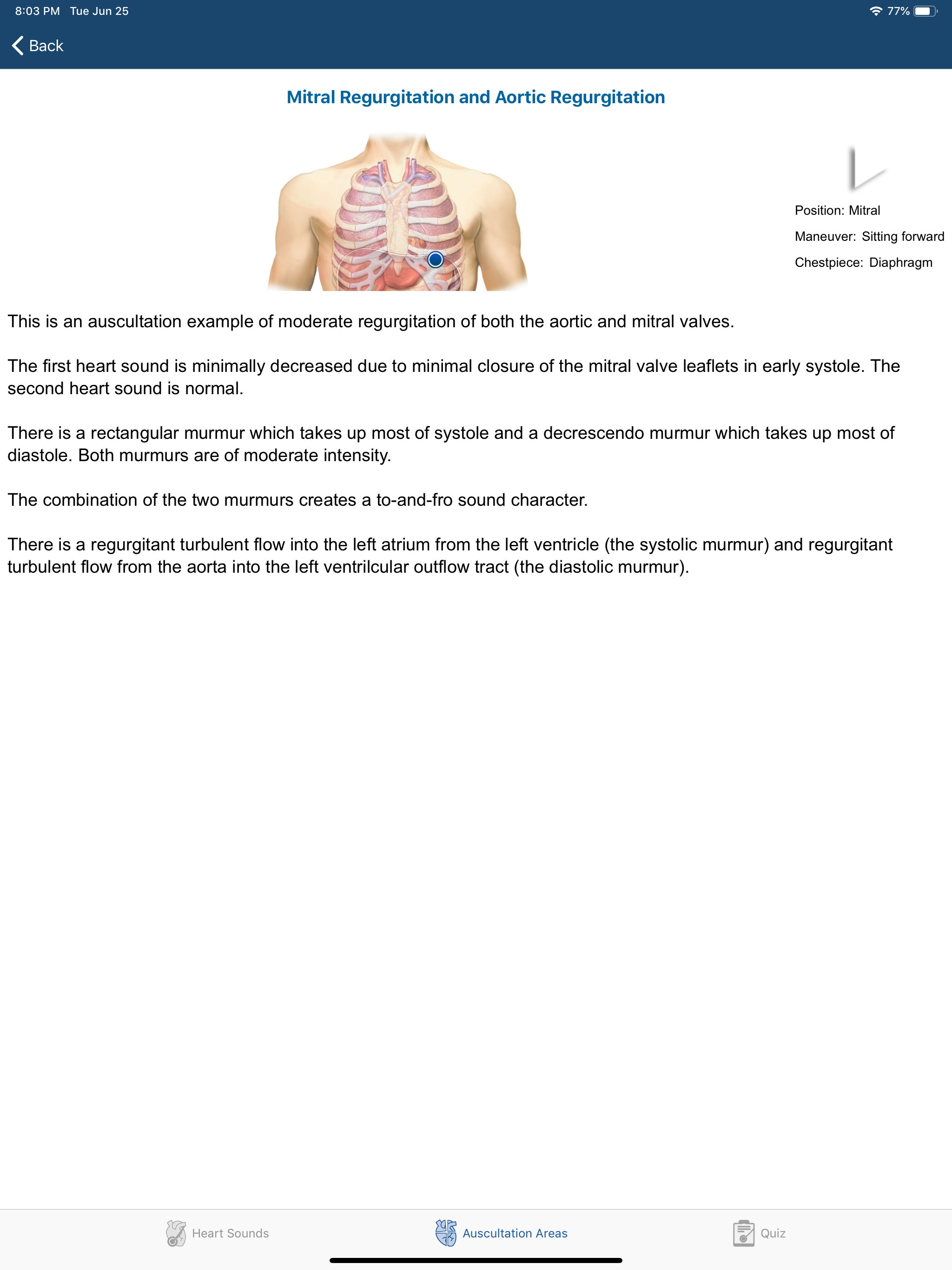 Heart Sounds Auscultation