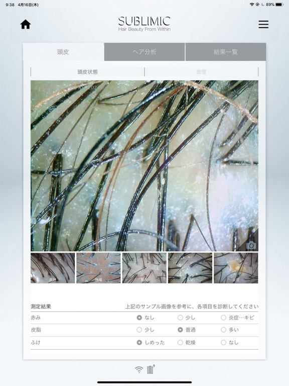 Screenshot #6 pour SUBLIMIC Hair & Scalp Check