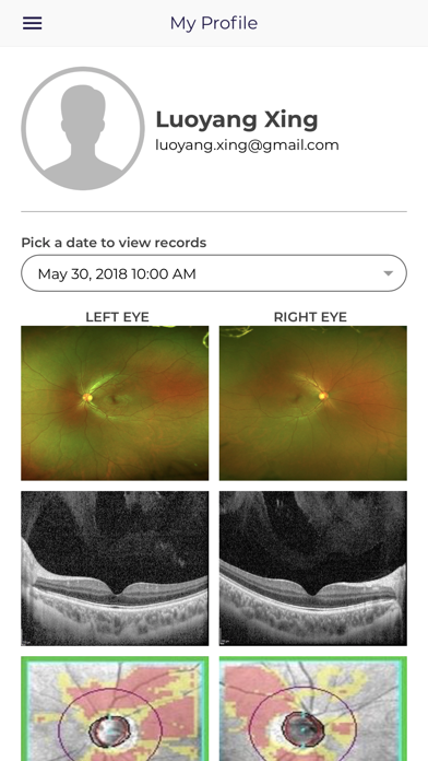 Asia Retina Screenshot
