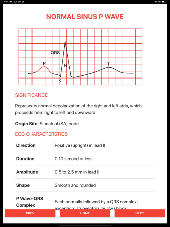 Screenshot #4 pour ECG FlashCards 2