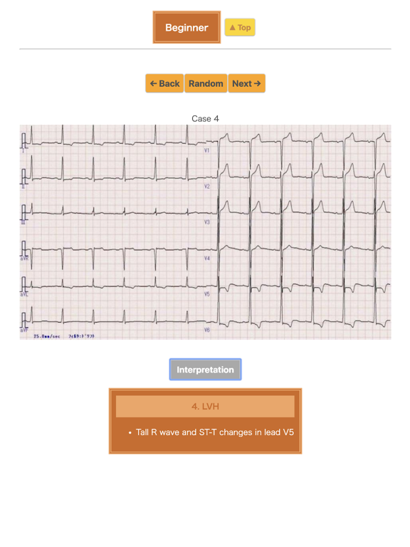 Screenshot #5 pour Pocket ECG
