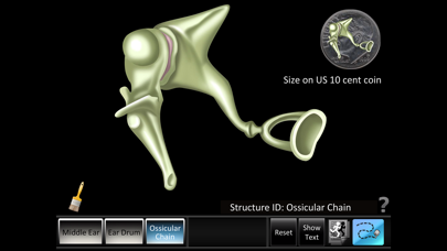 Screenshot #2 pour Middle Ear ID