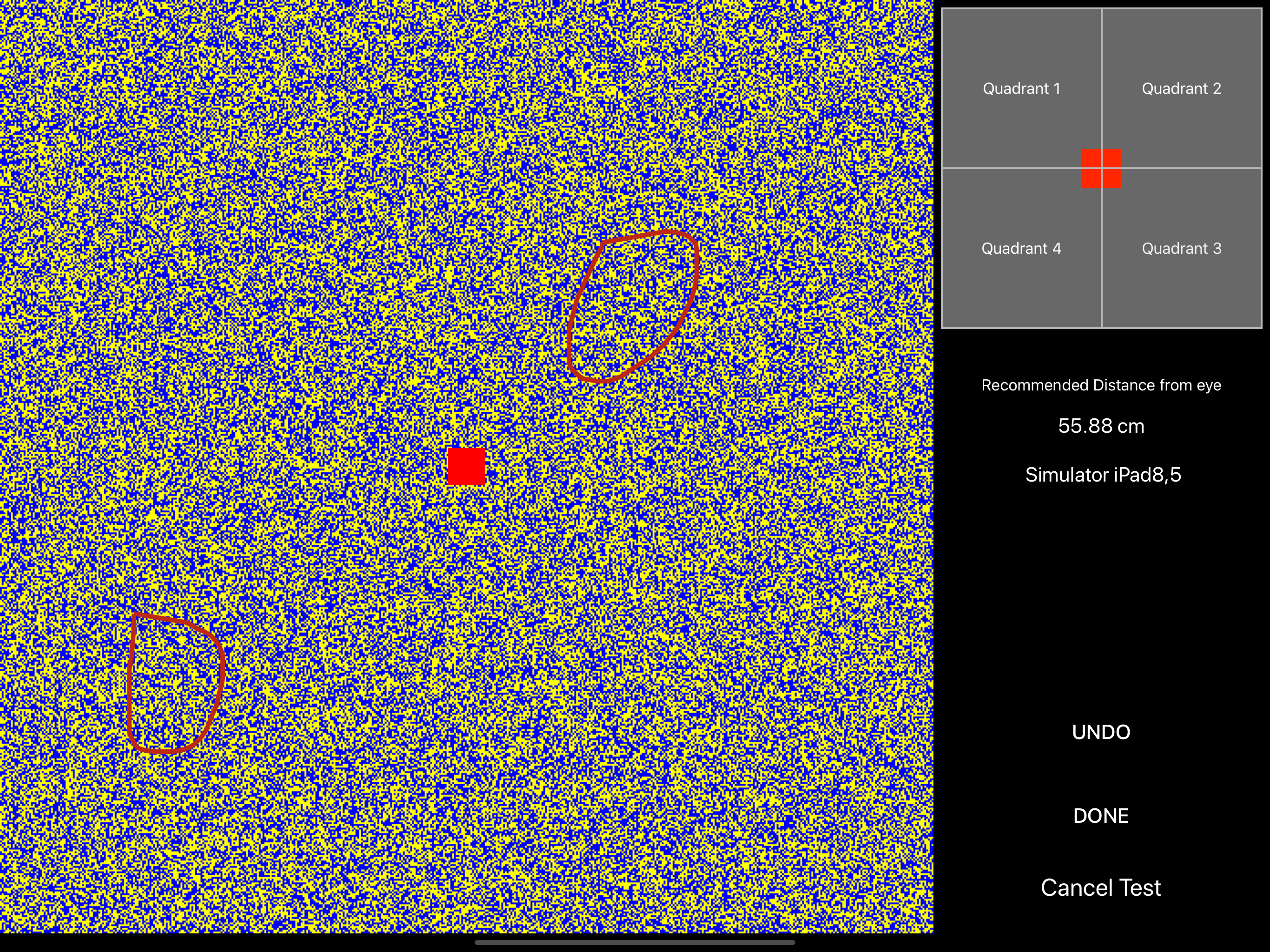Visual Field Fast Pro screenshot 4