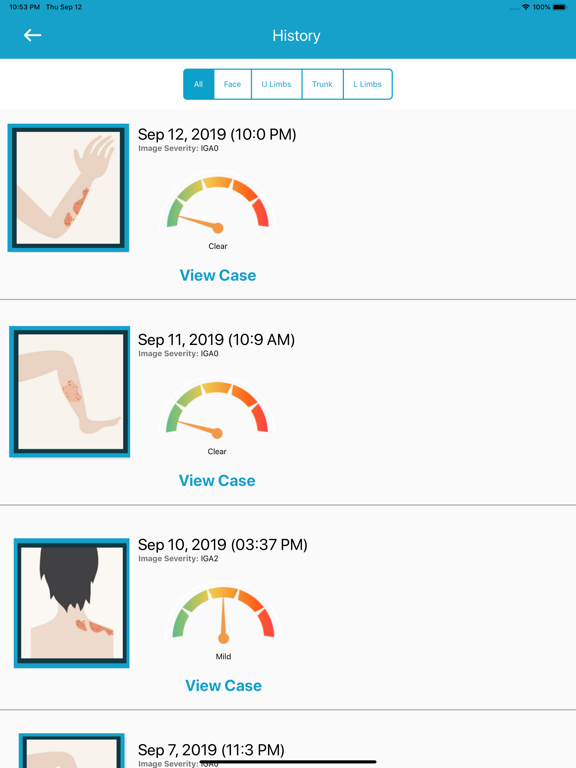 EczemaLess, an AI Eczema Guide iPad screenshot 5 - Health & Fitness app