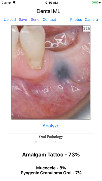 Dental ML Screenshot