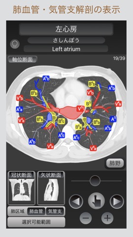 CT Passport コンプリートセット 脳・腹部・胸部のおすすめ画像8