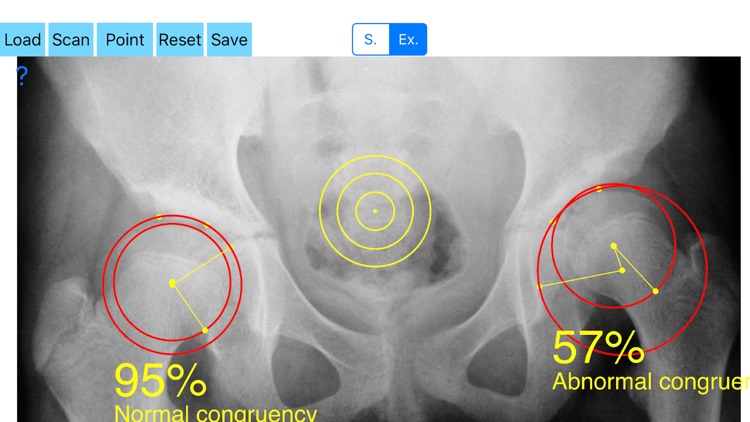 CongruenceIndexApp screenshot-4