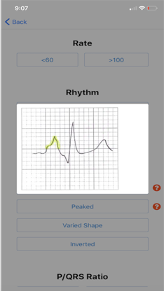 EKG DDX screenshot 3