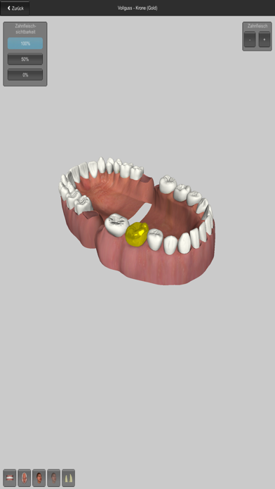 Screenshot #3 pour CGM VISODENT 3D App