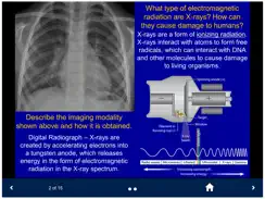 Basic Radiology - SecondLook iPad image 2